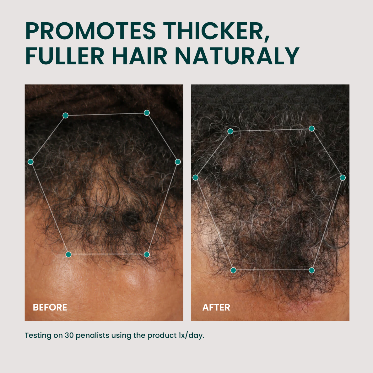 Natural DHT Blocker